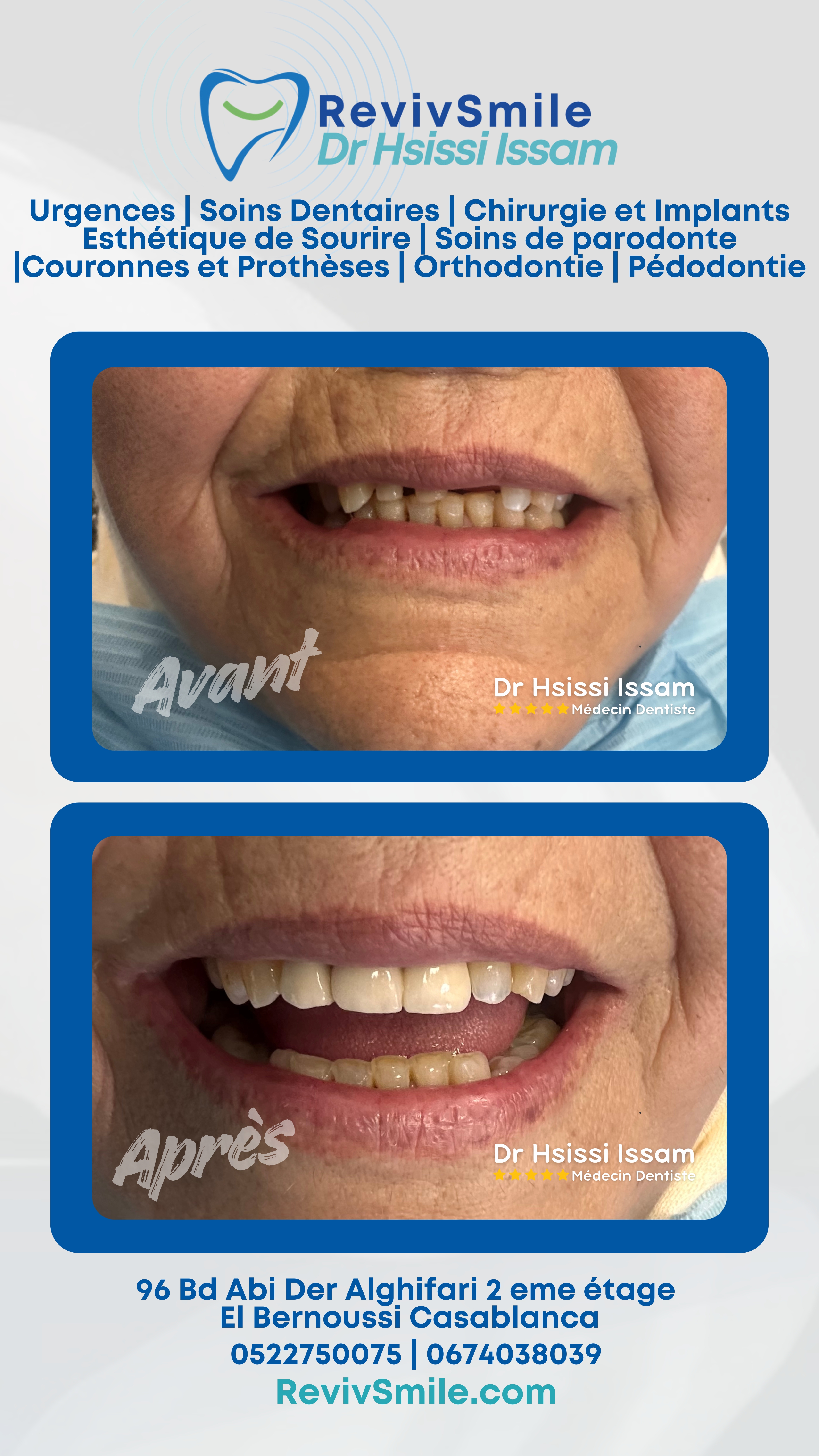 Clinique dentaire Hsissi Issam Casablanca • Orthodontiste ● Hollywood Smile ● Orthodontie ● Pédodontie